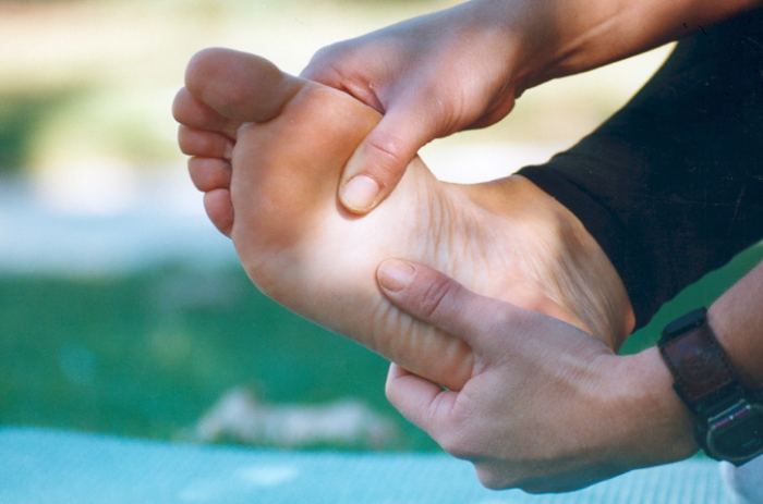 Fascitis plantar (Foto: Saluspot)