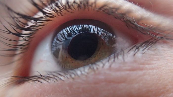 ojo glaucoma