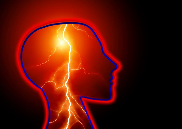 epilepsia ictus cerebro
